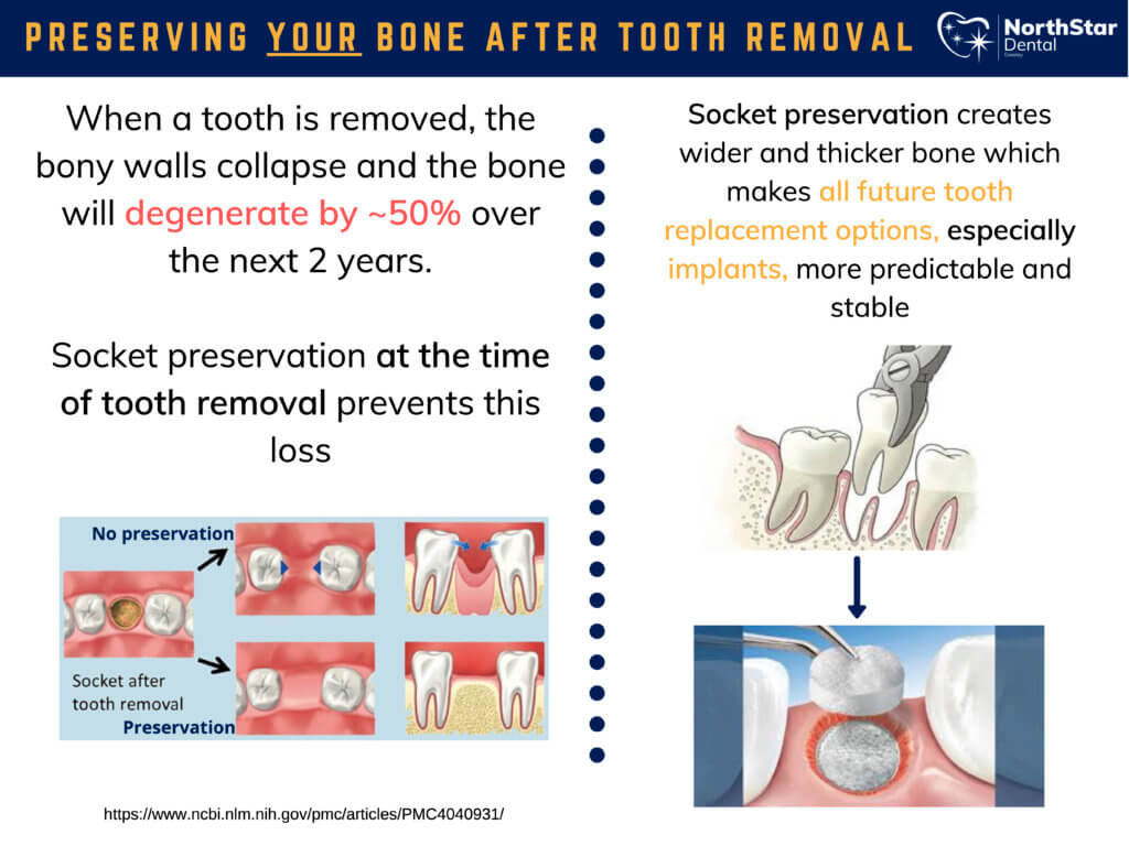 Bone Preservation